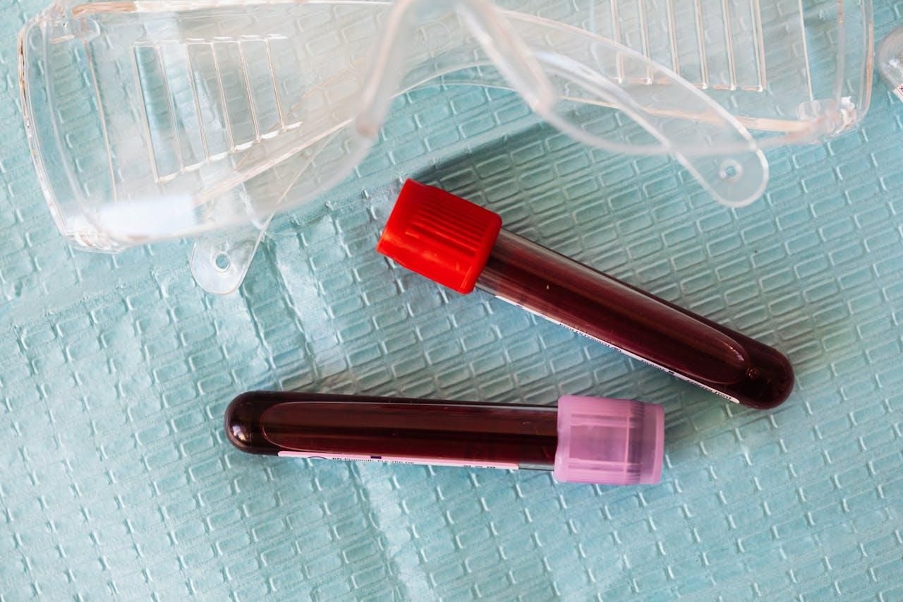 French scientists find new blood type in Guadeloupe woman