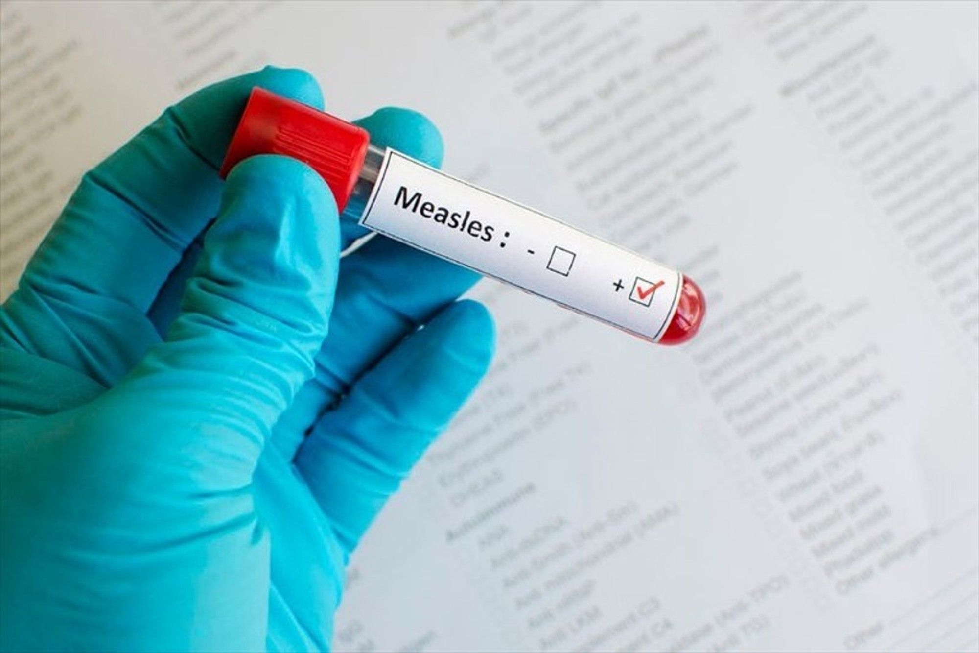 Gauteng's urgent campaign to vaccinate over 4 million children against measles and rubella