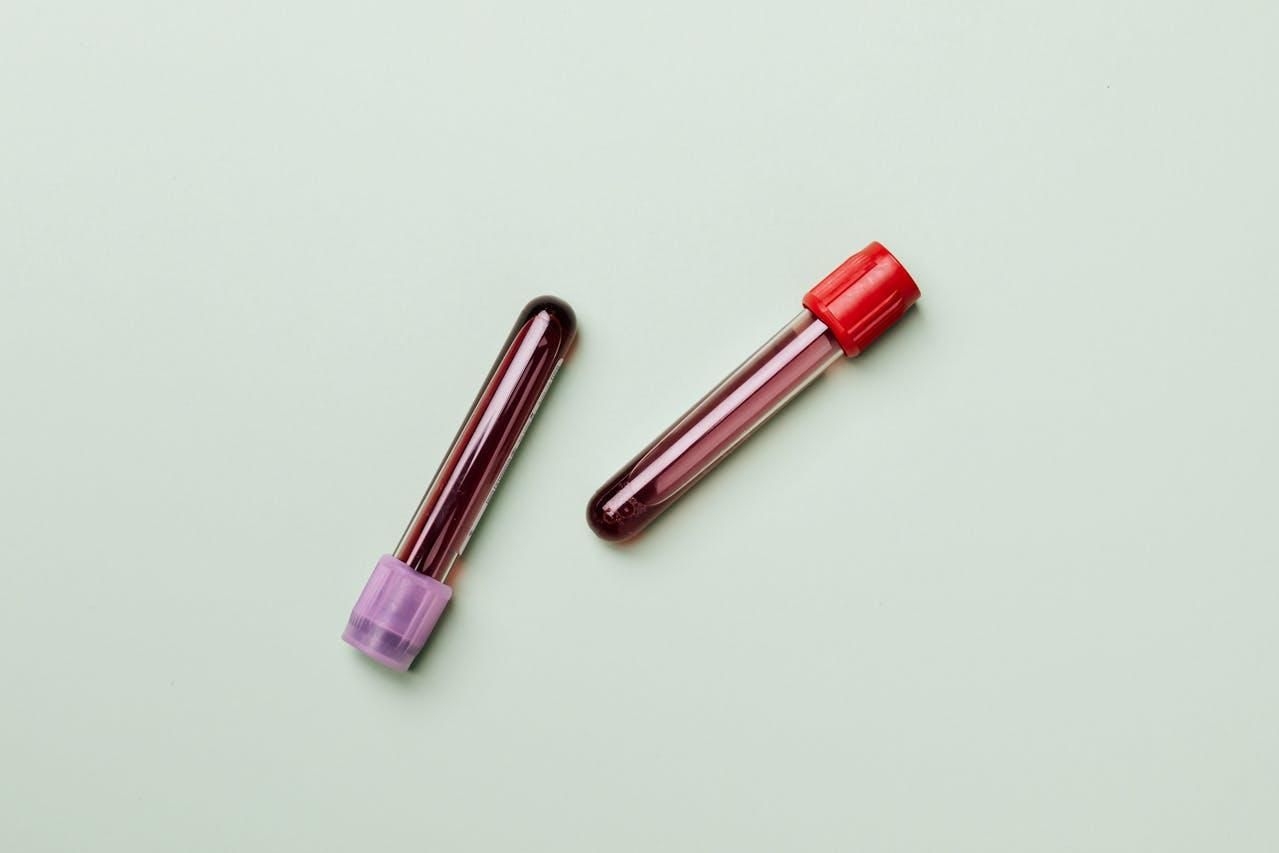 Artificial blood breakthrough: Japanese scientists develop universal solution for all blood types