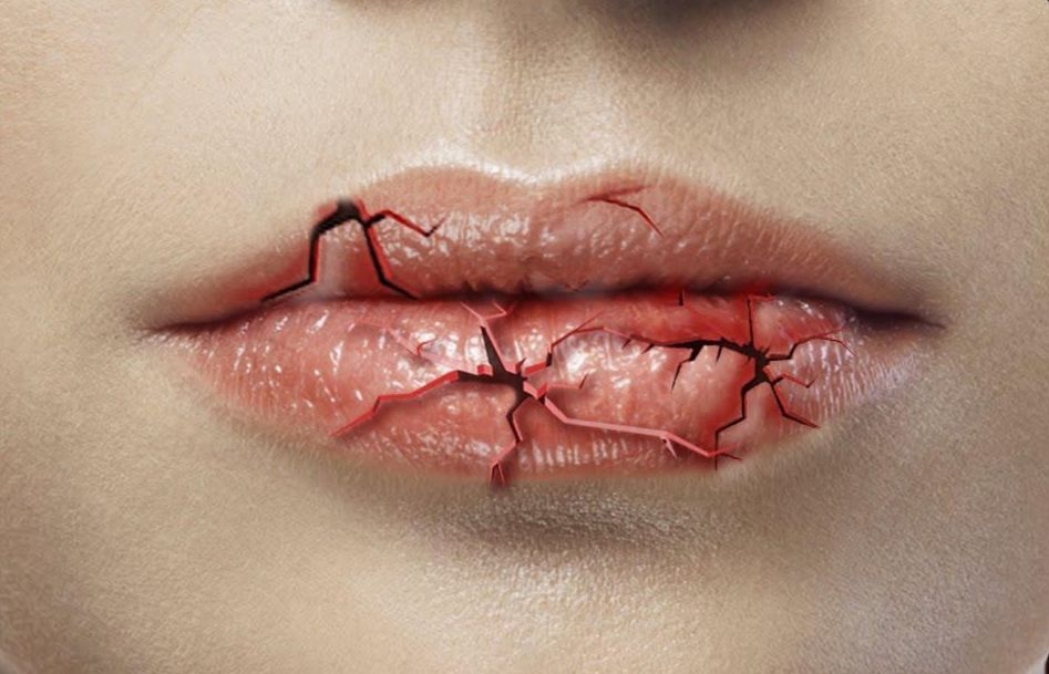 Winter skincare: 7 tips for soothing sensitive lips and skin