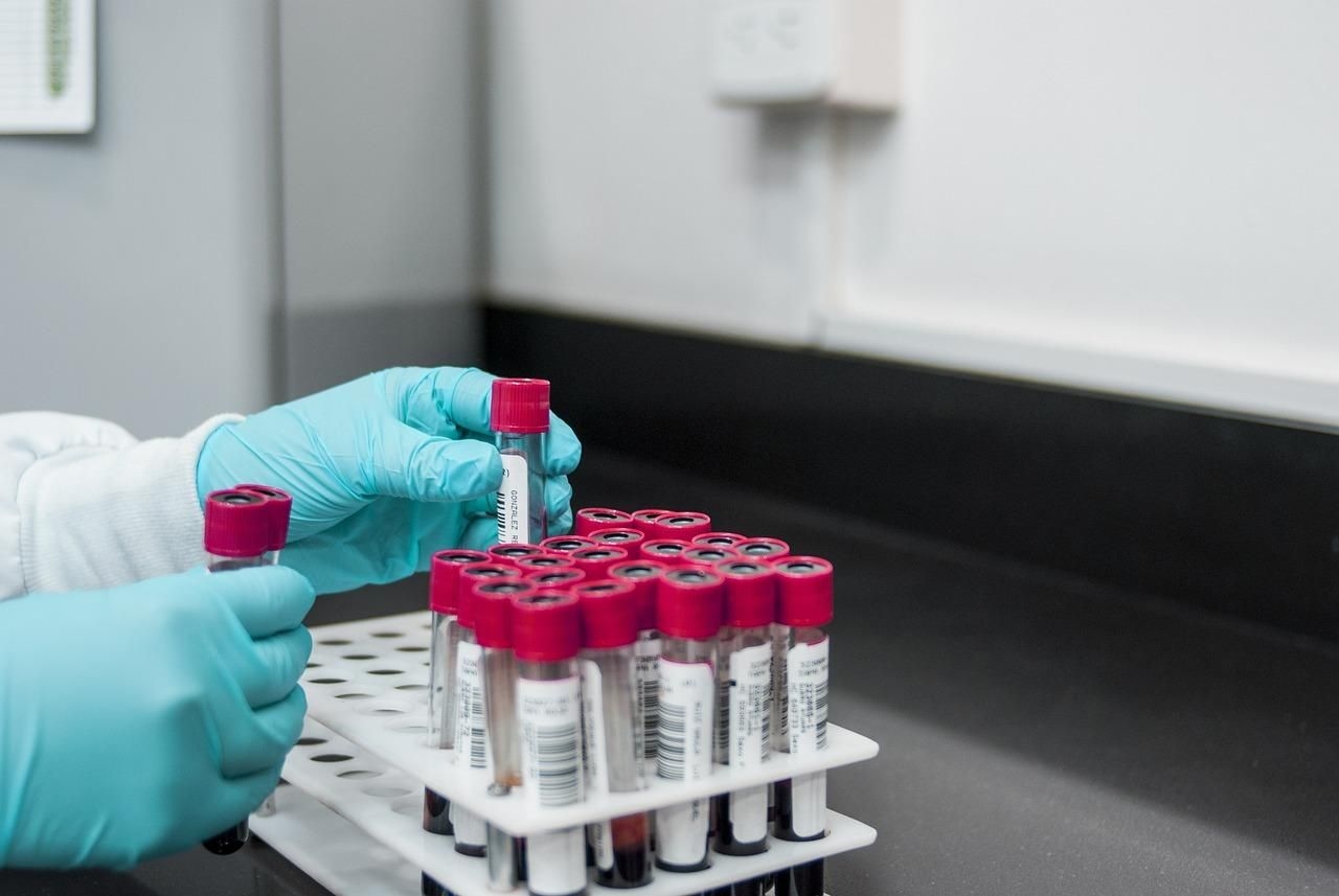 South Africa's targeted mpox vaccination drive to combat rising cases