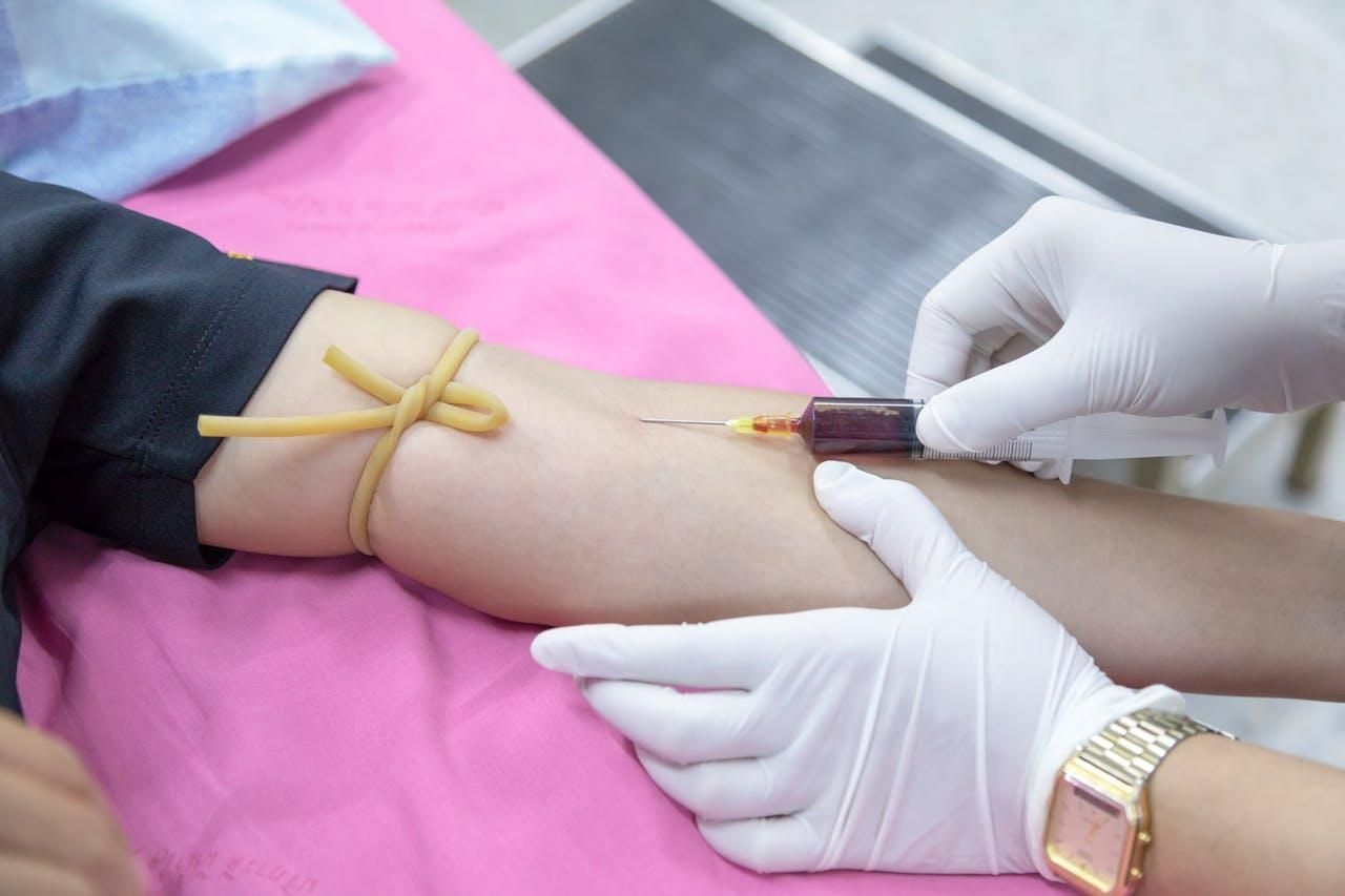 Iron deficiency on the rise: WHO warns of 15% increase in anaemia among African youth