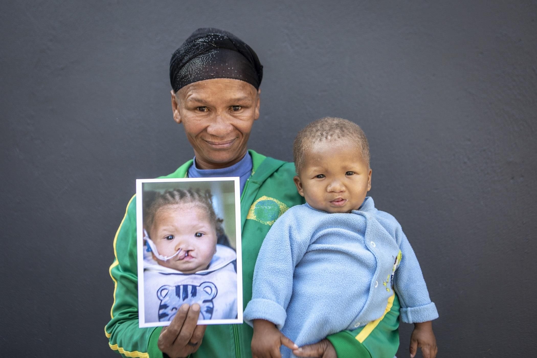 Medical professionals from Gauteng part of Operation Smile's record-setting weekend in Mbombela