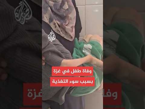 مصدر طبي بمستشفى شهداء الأقصى: وفاة الطفل تامر شحيبر بسبب سوء التغذية - إيطاليا تلغراف