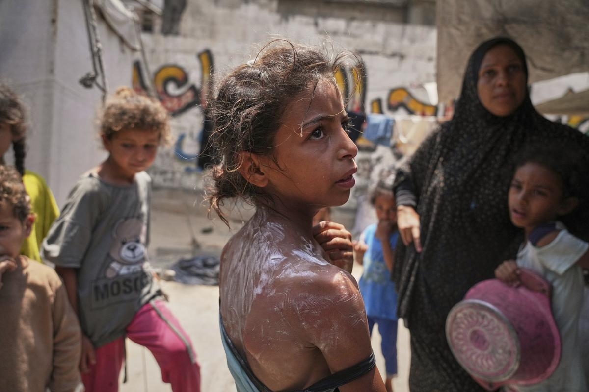 36 Palestinians Killed Trying to Obtain Desperately Needed Aid in Gaza, Officials Say