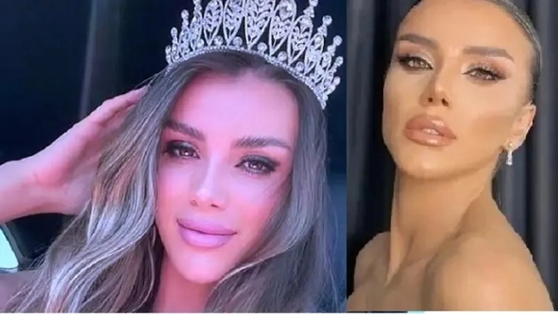 مصرع ملكة جمال دهساً بالعجلات وهي سكرانة تهرب من الشرطة