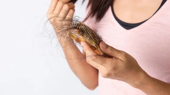 7 فيتامينات ومعادن يجب فحصها عند تساقط شعر النساء