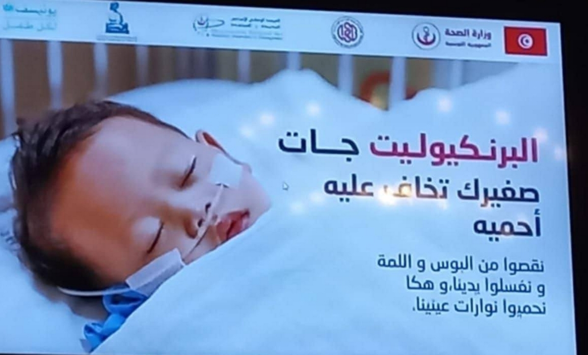 مستشفى الأطفال يستقبل حوالي 400 طفل مصاب بالبرونكوليت خلال 24 ساعة