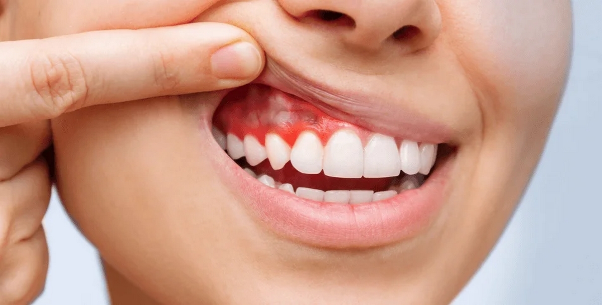 صحة الفم في خطر: 5 أخطاء شائعة أثناء تنظيف الأسنان.
