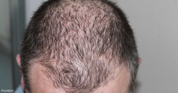 7 علامات تدل على نقص معدن مهم في الجسم.. تعرف عليها