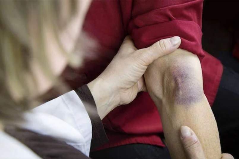 إطلاق حملة وطنية للتحسيس بمرض الهيموفيليا