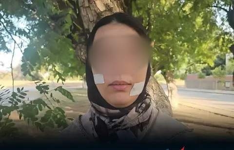 سنتان ونصف سجنا نافذا لمتهم في قضية تشويه وجه سيدة