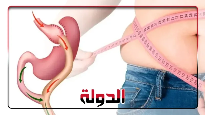نصائح غذائية بعد جراحة السمنة للحفاظ على وزنك