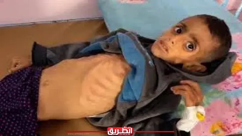 عمر.. صمت طفل من غزة تحوّل إلى صرخة في وجه العالم