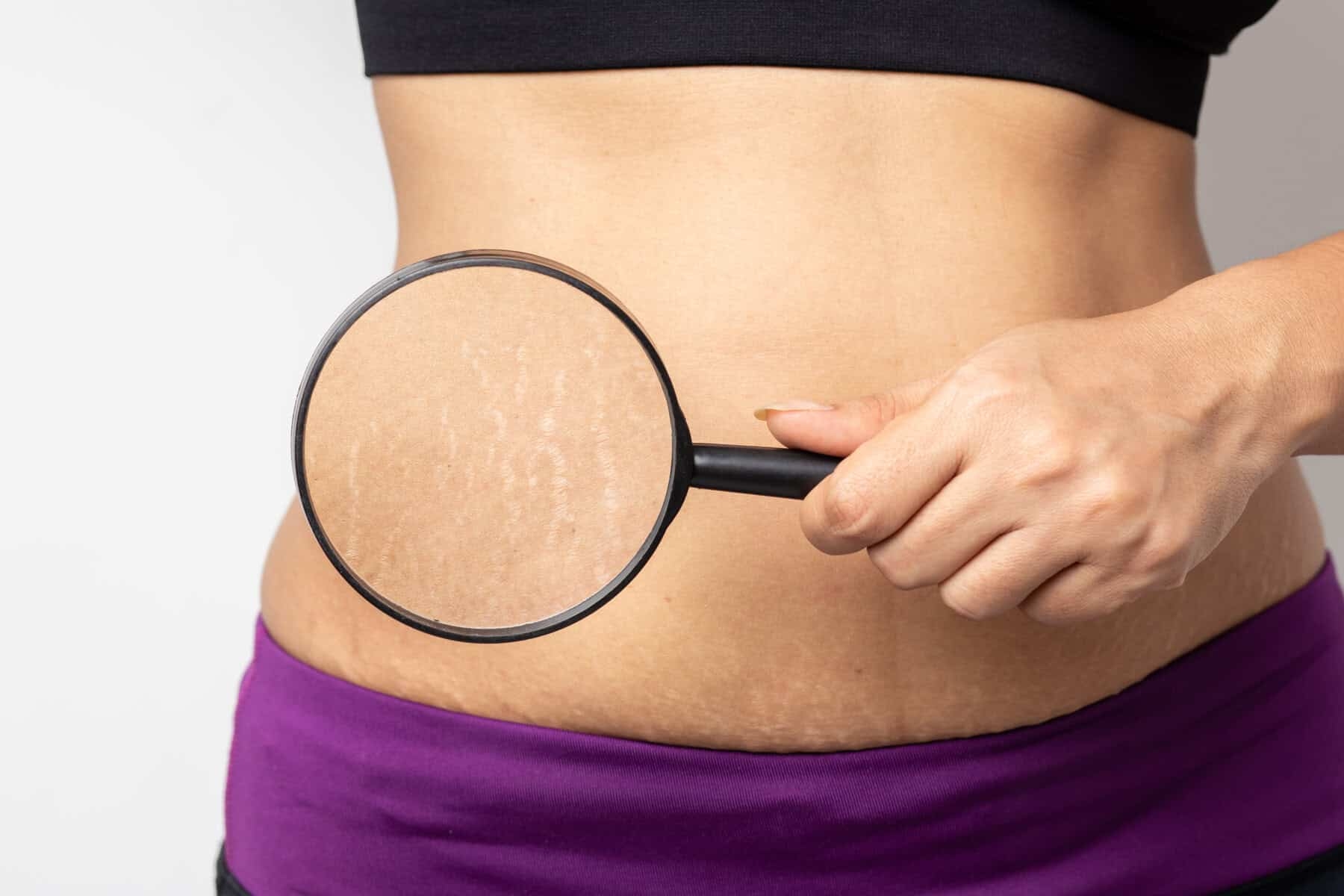 Skin self-care during pregnancy
