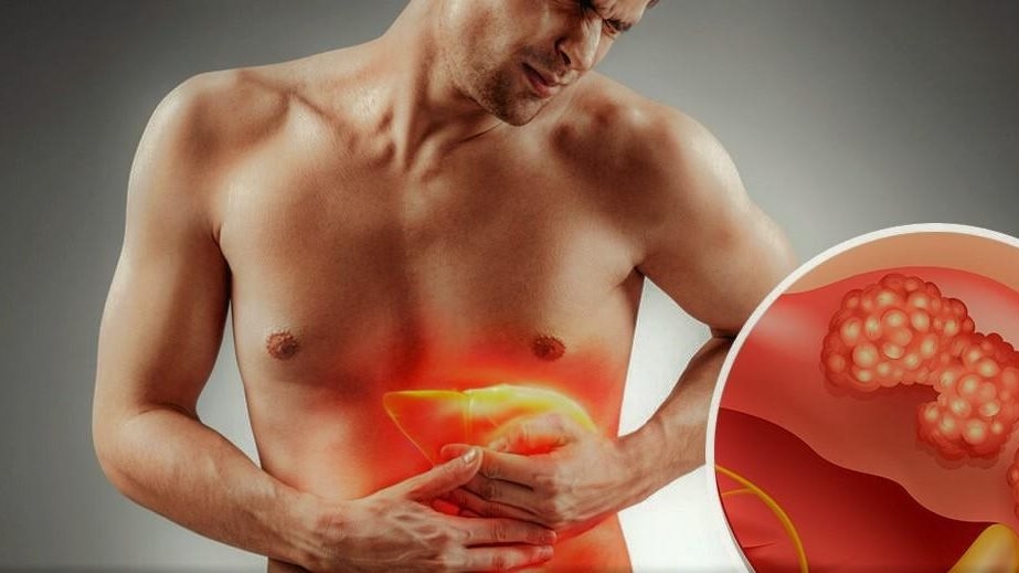 10 أطعمة طبيعية لتطهير الكبد من السموم والدهون