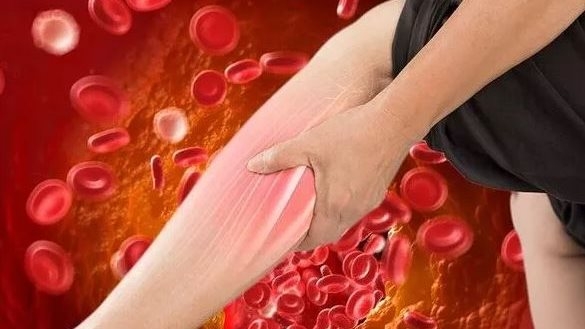 أورام وأمراض جلدية.. ماذا يحدث عند وضع المانيكير باستمرار؟ ماسك الأرز الأنسب لبشرتك في الصيف.. ماذا يحدث لجسم طفلك بعد تمرينات السباحة؟