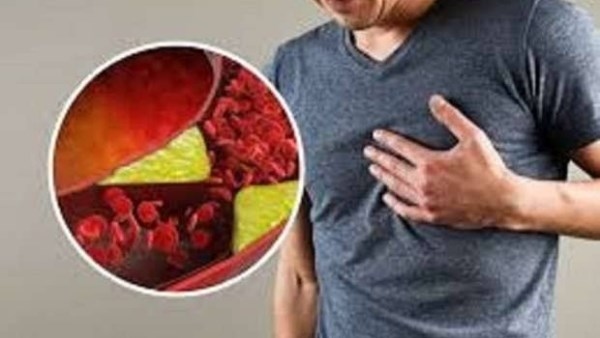 للكبار والصغار.. أطعمة تقلل مستوى الكوليسترول الضار بالجسم