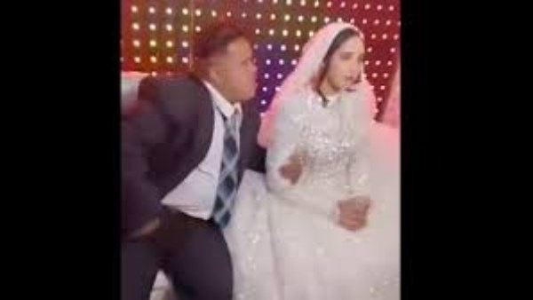 العروسة طفلة.. تفاصيل التحقيق مع عريس متلازمة داون