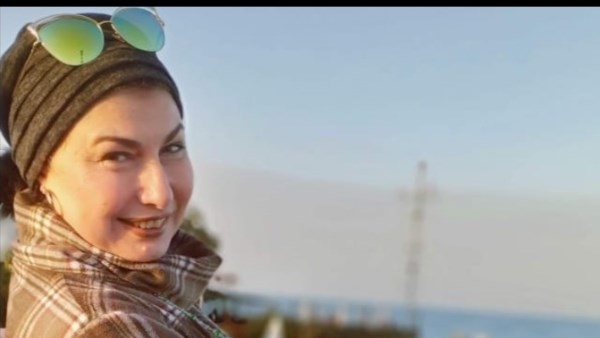 جميلة عزيز تكشف عن تطورات إصابتها في عينها .. خاص