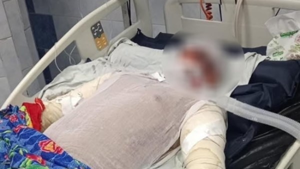 مدير مستشفى الجمعية الشرعية: ضحية حريق شبرا الخيمة وصل في حالة حرجة