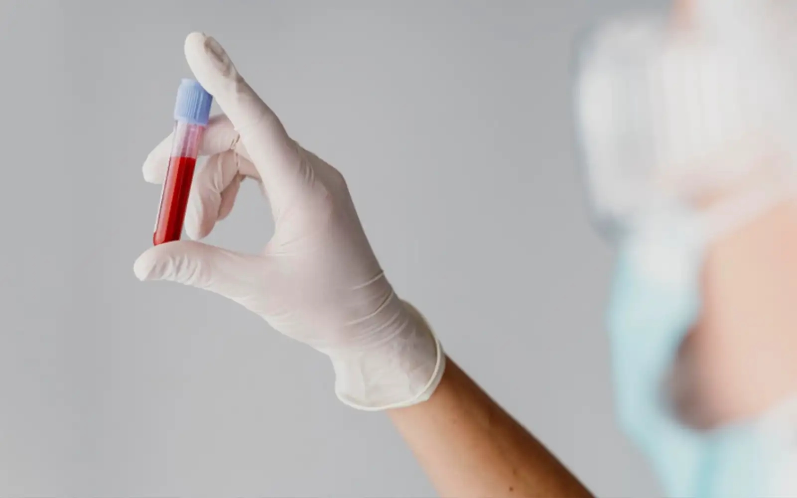 AI-powered blood test allows for early breast cancer detection
