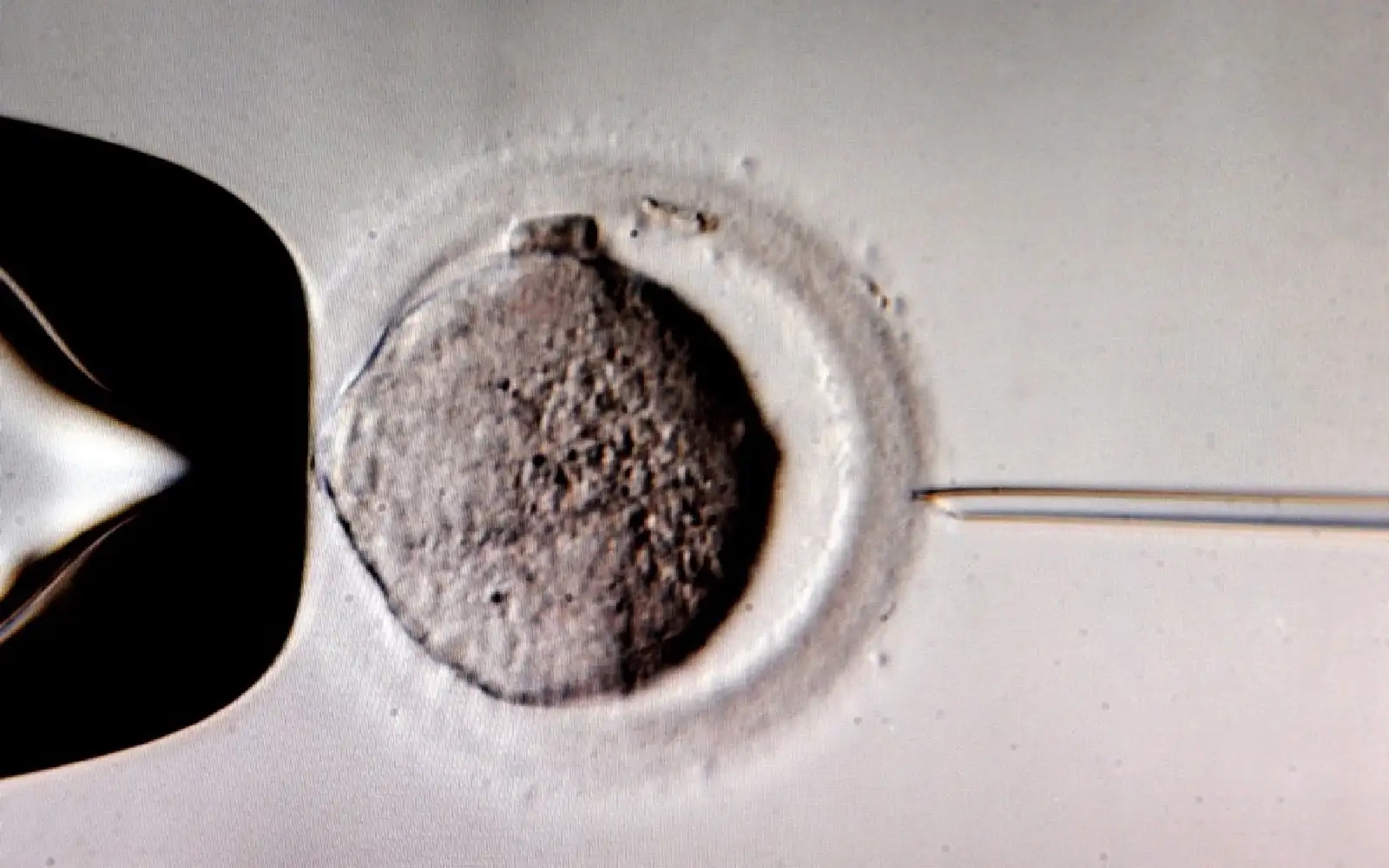 Second Australian IVF mix-up shakes clinic and industry