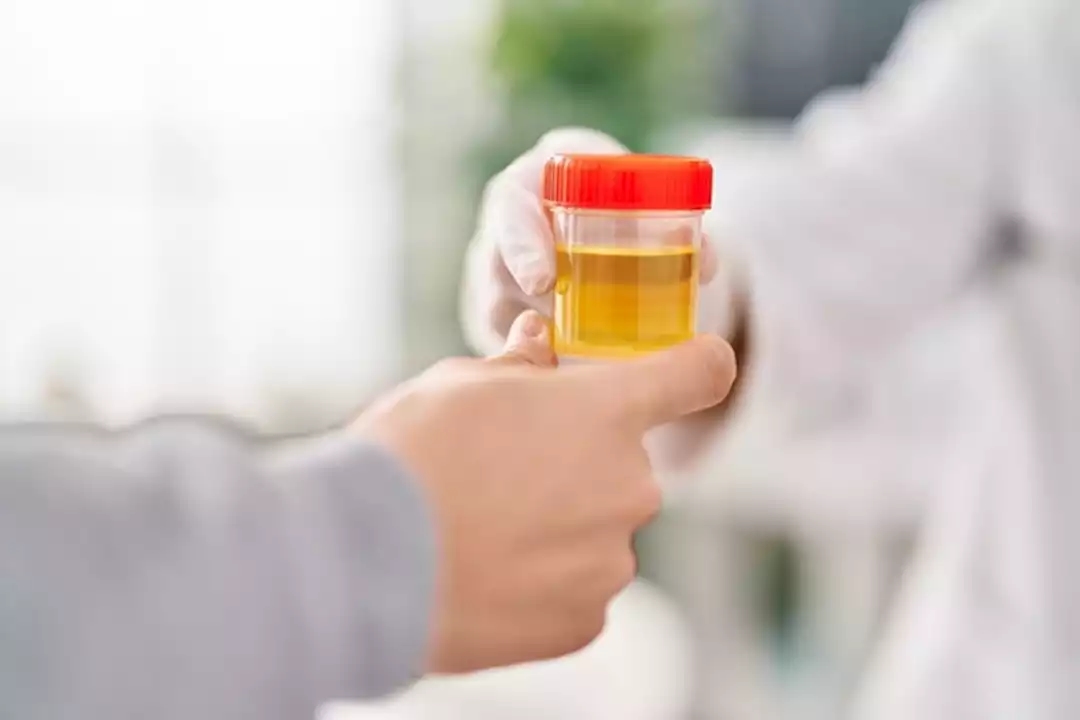 علامة في البول تكشف إصابتك بـ 3 أمراض خطيرة