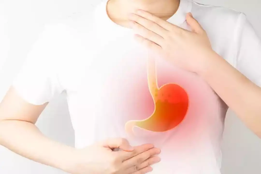 10 أطعمة تزيد من ارتجاع المريء.. ابتعد عنها في رمضان