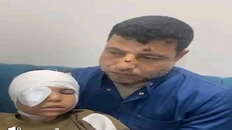 "عينها اليمين اتصفت".. إصابة طفلة بعد تعرضها للرشق بالحجارة في قطار بالمنوفية- صور