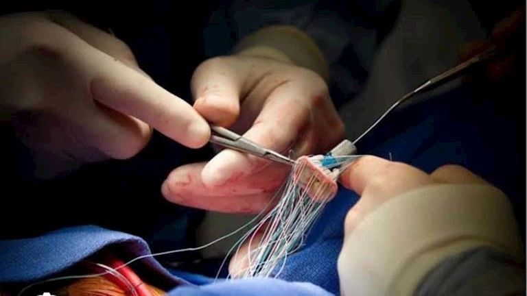 إنقاذ مريضة أصيبت بانسداد بالصمام الميترالي في مستشفى شرق المدينة بالإسكندرية -صور