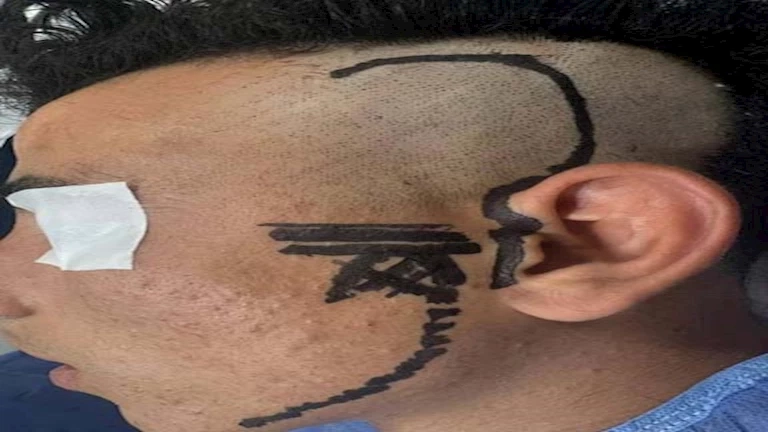باستخدام الذكاء الاصطناعي.. نجاح جراحة دقيقة لتحرير فك مريض فى مستشفى العامرية العام