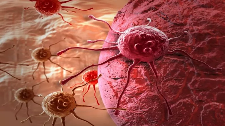 احذر.. تواجد هذه العلامات على جسمك دليل على الإصابة بالسرطان