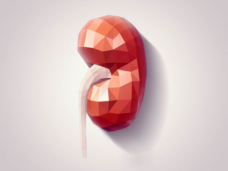 Kidney Removal
