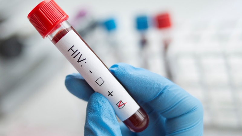 UNAIDS: HIV deaths to surge without US funding