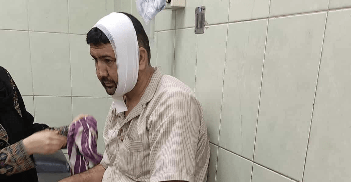 Kirkuk: Arab man injured protecting Turkmen neighbor from assailants