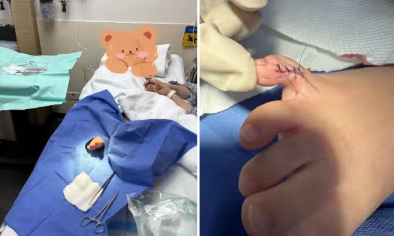 Chinese tourist insists Sentosa beach club should foot $1,252 medical bill after her child suffers toe injury