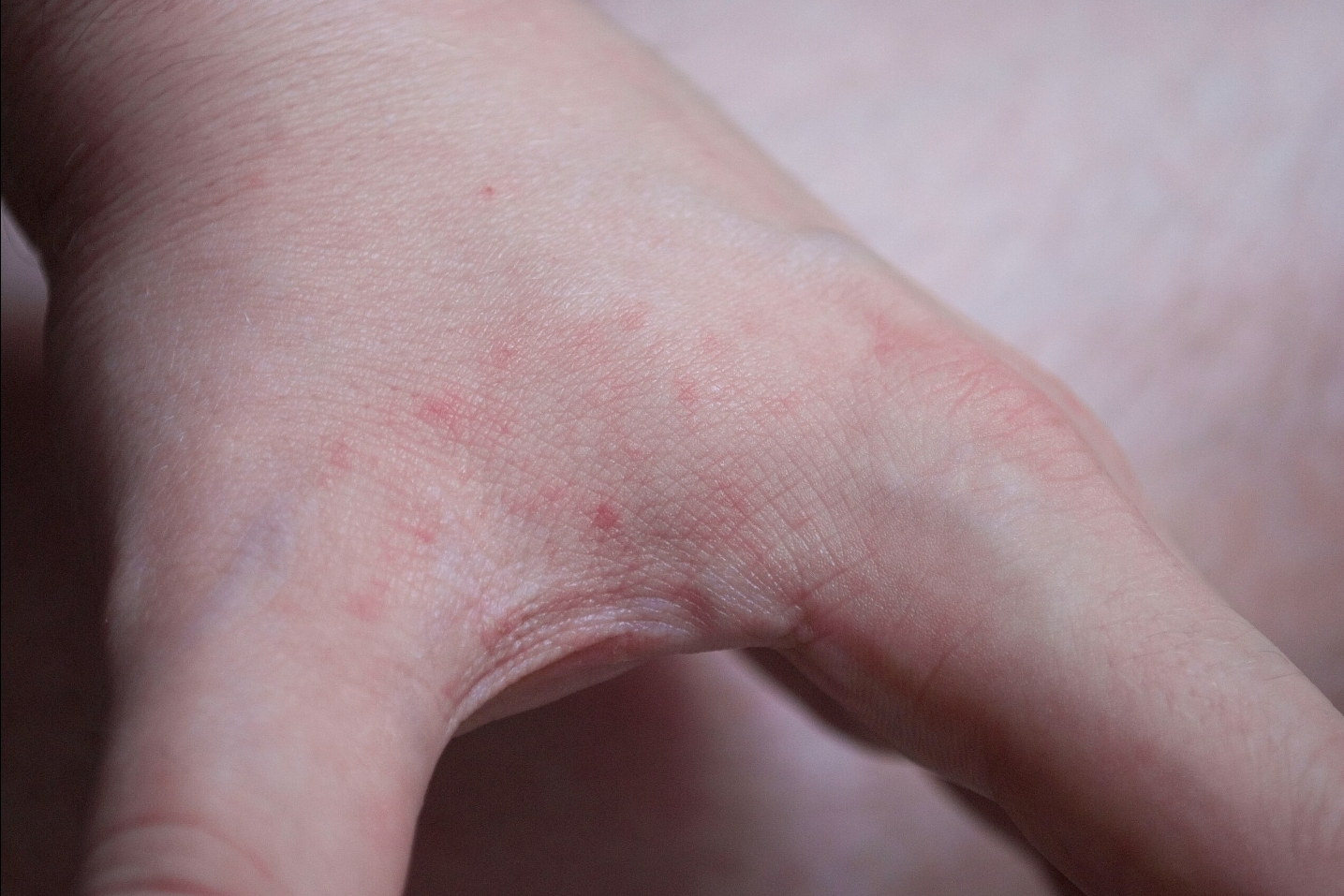 Bedbug complaints lead to Suntec City Rest N Go massage chairs getting roped off