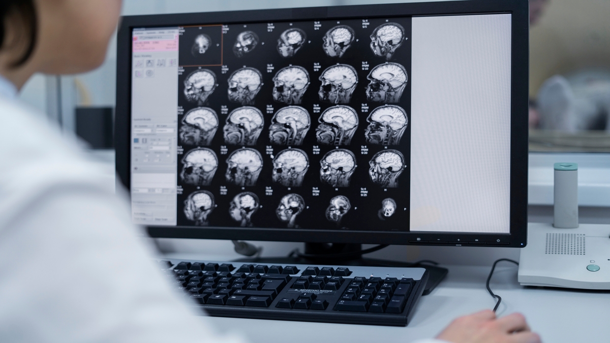 Cheaper brain cancer test provides more accurate results in just 2 hours