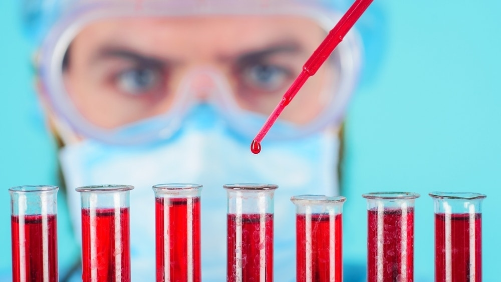 Exact Sciences Dip A Chance To Buy As Freenome Deal Fortifies Future: Analyst