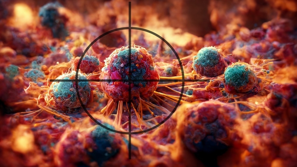 NovoCure's Tumor Treating Fields Boost One-Year And Pain-Free Survival In Pancreatic Cancer Trial
