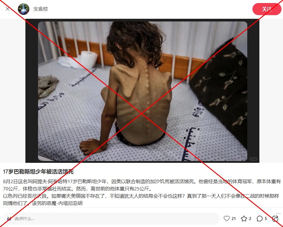 Photo shows 7-year-old child in Gaza, not dead teenager