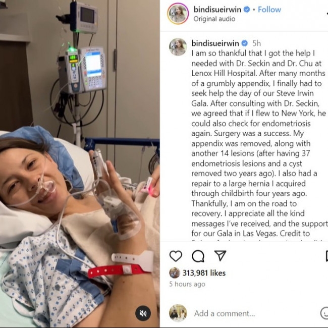 Bindi Irwin 'on road to recovery' after having appendix and 14 endometriosis lesions removed