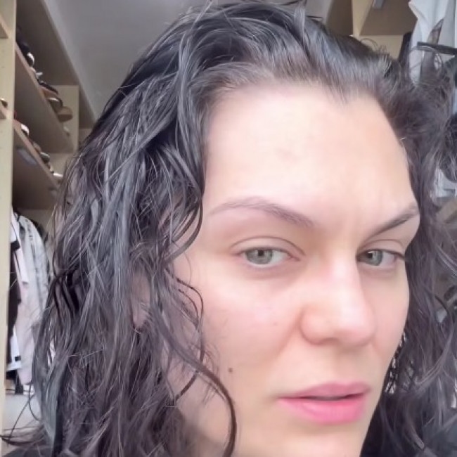 Jessie J's hair 'is falling out like crazy'