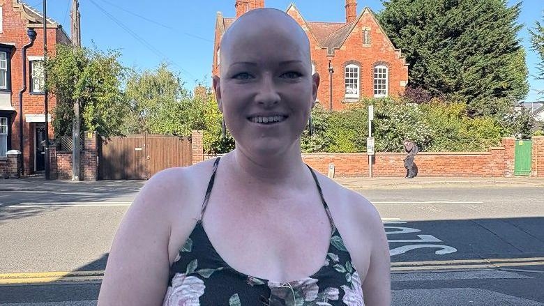 Hairdresser wants to share own alopecia story