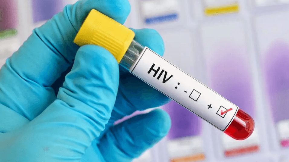 HIV tests encouraged as campaign launches
