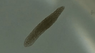 How flatworms could help treat schizophrenia
