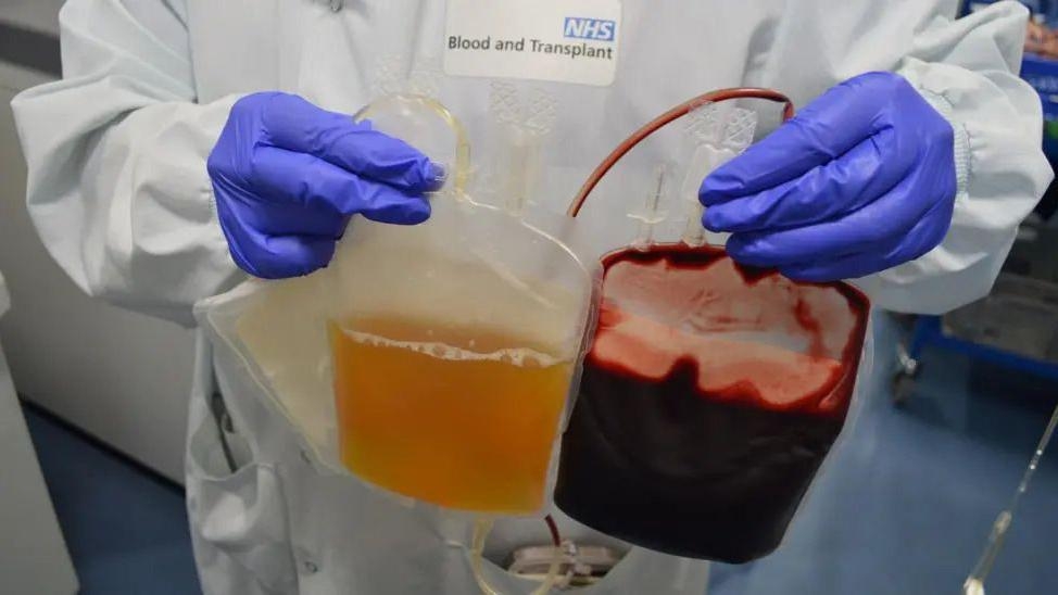 Kent NHS patients benefit from UK-sourced plasma