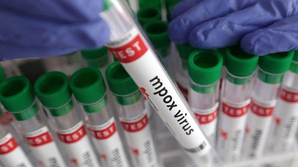First case of newer mpox variant detected in Ireland