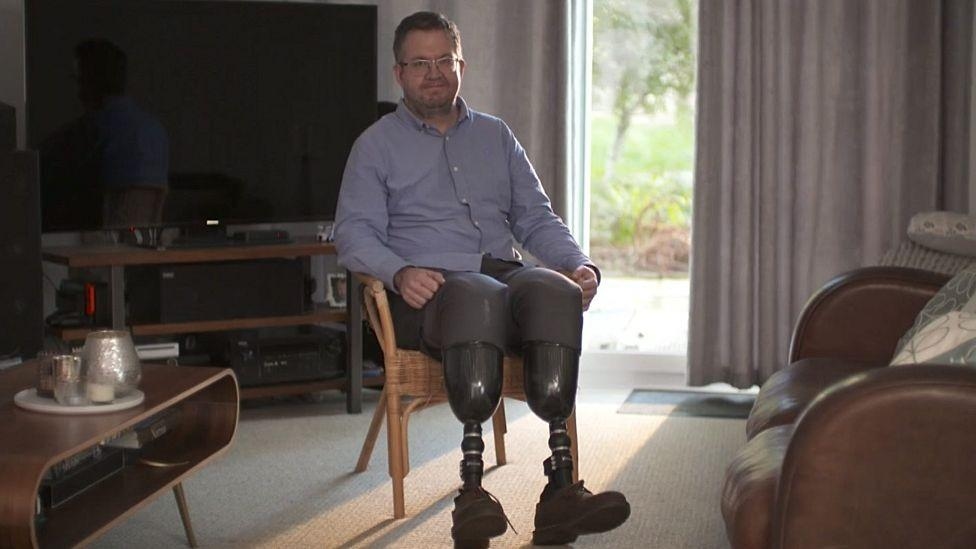 Surgeon accused of fraud over his leg amputations
